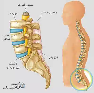 دیسک کمر و روش های جدید درمان دیسک کمر