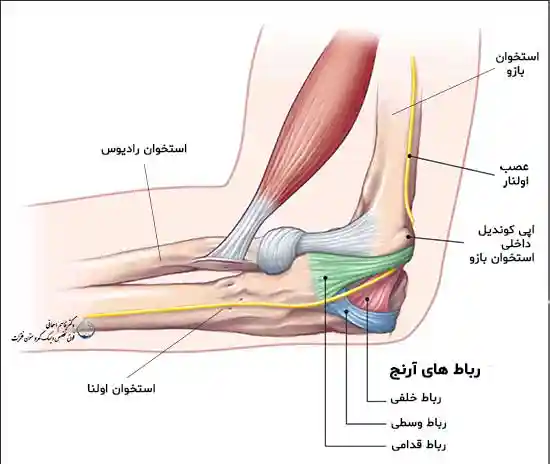 درد آرنج و روش های درمان درد آرنج