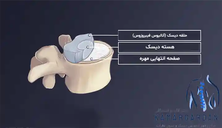 دیسک بین مهره ای