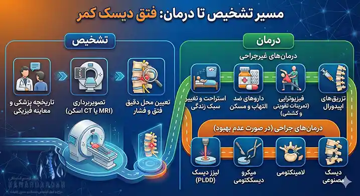 تشخیص فتق دیسک کمر