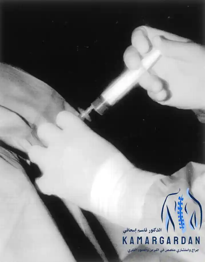 العلاج الجراحي البسيط لتمزق القرص القطني بالأوزون