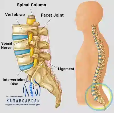 Lumbar disc herniation or lumbar disc disease