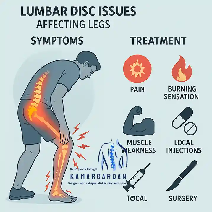 Symptoms of a herniated disc in the legs