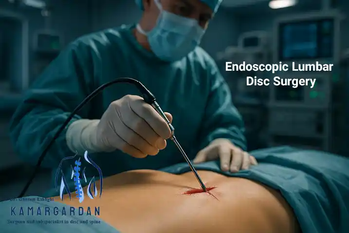 Endoscopic Lumbar Disc Surgery